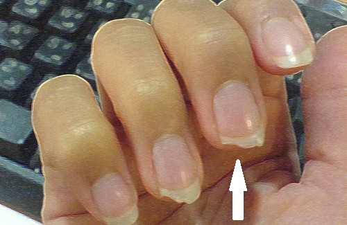 comment reparer les ongles qui se dedoublent