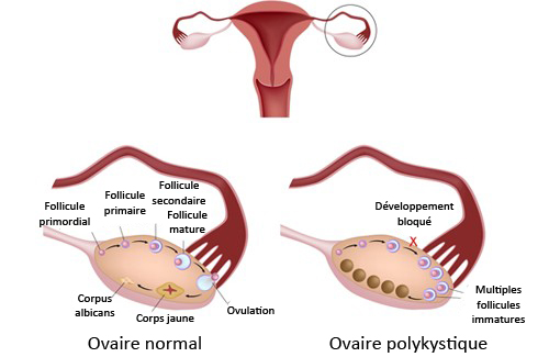 comment renforcer les ovaires