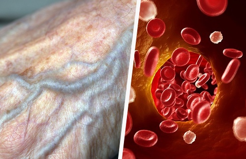 Natural Tips to improve blood circulation
