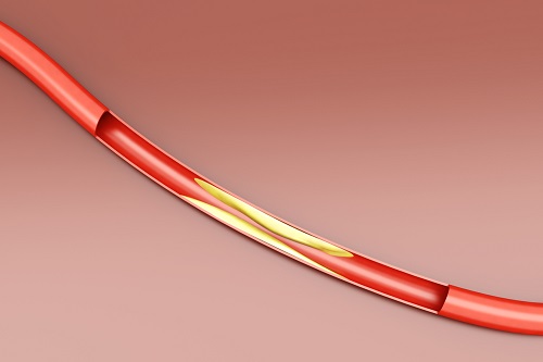 Cholestérol