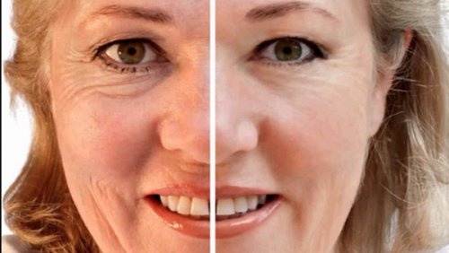Les masques pour la personne avec le miel pour la peau sensible