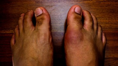 8 aliments qui peuvent entraîner la goutte