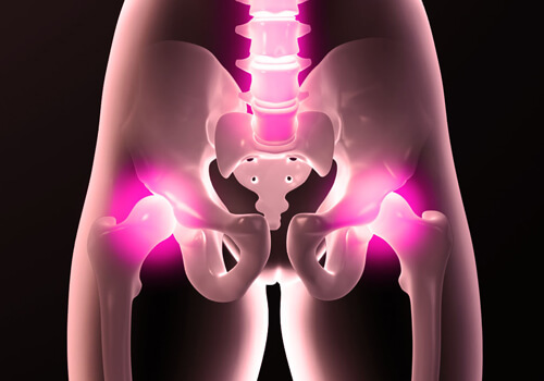 D'où viennent les douleurs de la hanche ?