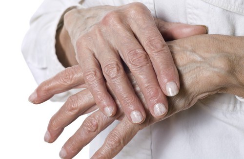 Remèdes naturels pour les gerçures des mains - Améliore ta Santé