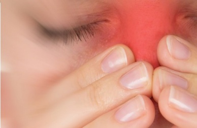 5 remèdes naturels pour lutter contre la sinusite