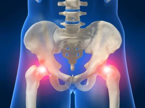 Les douleurs de la hanche