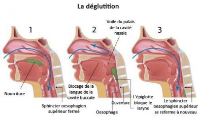 Que faire lors d'un étouffement : la manoeuvre de Heimlich