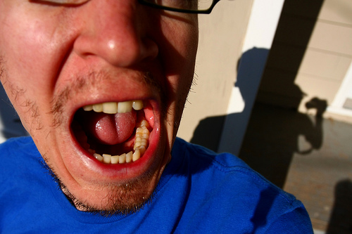 mal de dents