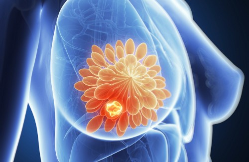 L'alimentation idéale pour éviter les kystes aux seins