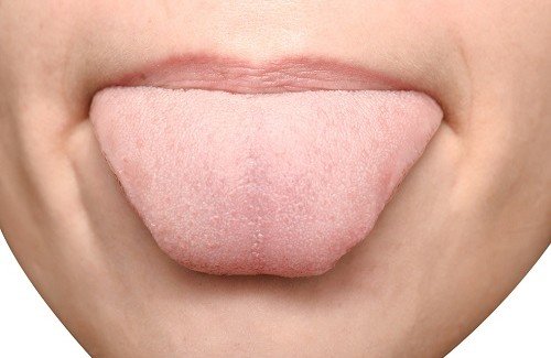 Les marques sur la langue : ce qu'elles signifient