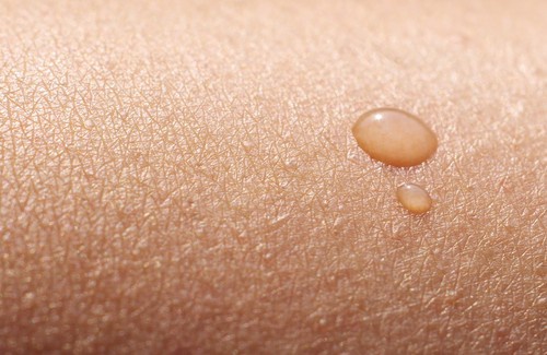 peau sèche 1