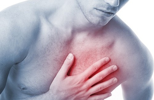 Quels sont les symptômes d'une crise cardiaque ?