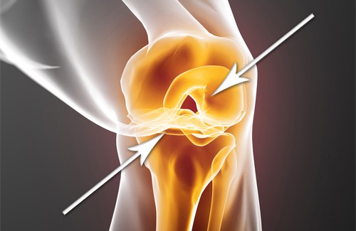 Comment régénérer des cartilages endommagés ?