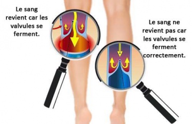 Comment améliorer la circulation des bras et des jambes