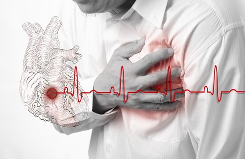 Savez-vous reconnaître les symptômes d'un infarctus ?