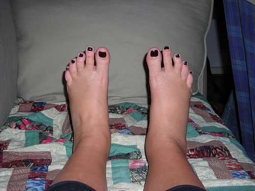 inflammation des chevilles