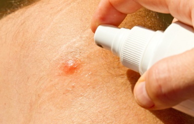 Les meilleurs produits anti-moustiques maison