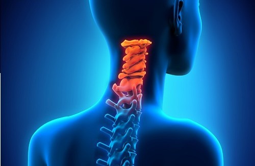 Comment prévenir l'arthrose cervicale ?