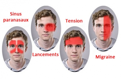 Un nouveau traitement efficace contre la migraine découvert !