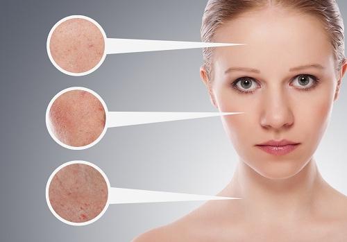 Différents problèmes de peau pour le front, les joues et le cou