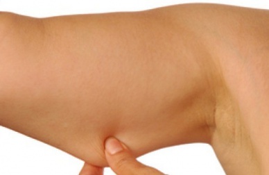 Conseils pour éviter les bras flasques