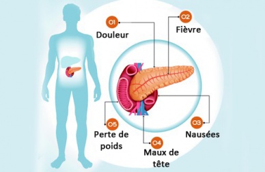 Le pancréas et ses problèmes : 6 symptômes