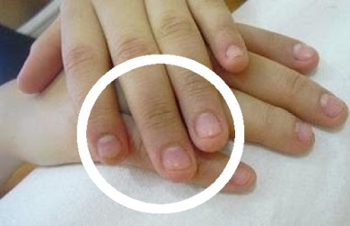 Les astuces pour ne pas se ronger les ongles