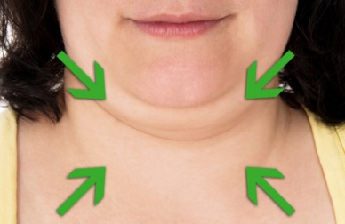 Des conseils et des remèdes pour réduire votre double menton