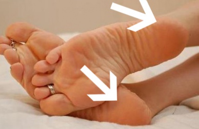 Des crèmes maison pour traiter les talons fendillés