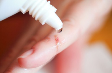 Comment soigner une blessure pour éviter les cicatrices ?