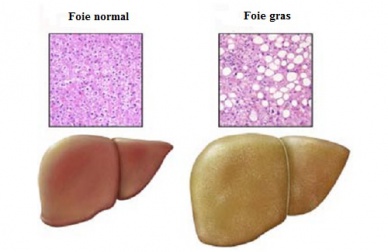 Maladie du foie gras : les aliments qu'il faut éviter