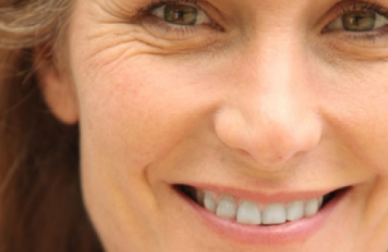 Rides sur le visage : prévenez leur apparition