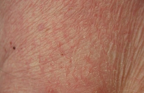 Que dit votre peau sur votre santé? Que dit votre peau sur votre santé?