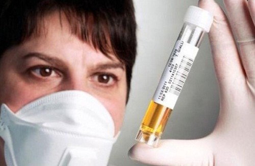 Que dit la couleur de l’urine sur votre santé? Que dit la couleur de l’urine sur votre santé?