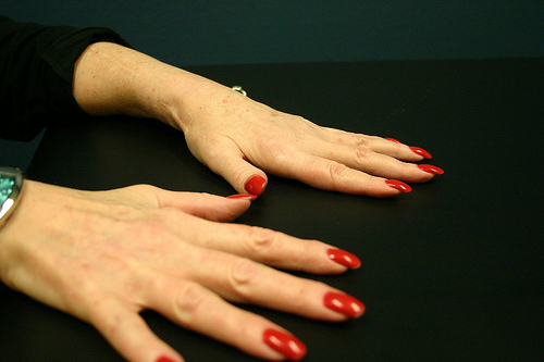 Les symptômes de l'arthrite sont nombreux.