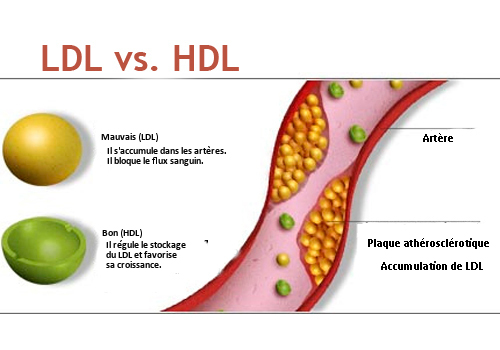 L'eau d'aubergine contre le cholestérol.