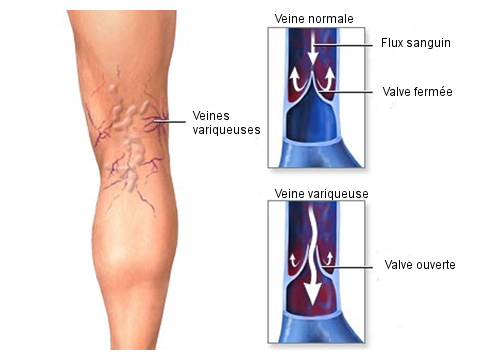 Bienfaits de la douche froide