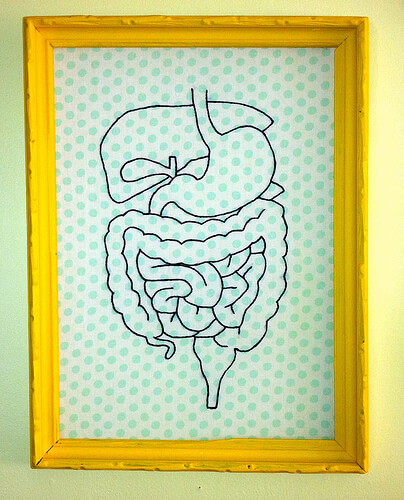 la diverticulose touche le côlon
