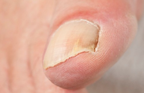 Belokourikha le traitement du psoriasis les sanatoriums de profil