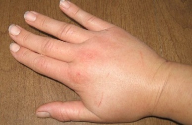 Prévenir naturellement la rétention d'eau