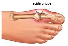 L'artichaut contre l'acide urique.