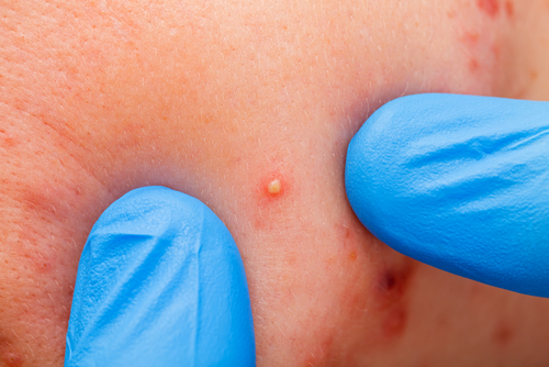 Traitements contre la vieillesse.