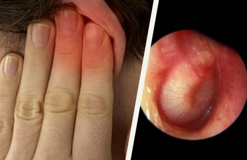 Infections aux oreilles : comment les soigner