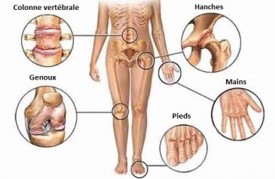 Conseils pour dire adieu aux douleurs articulaires