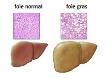 Les symptôme du foie trop gras.