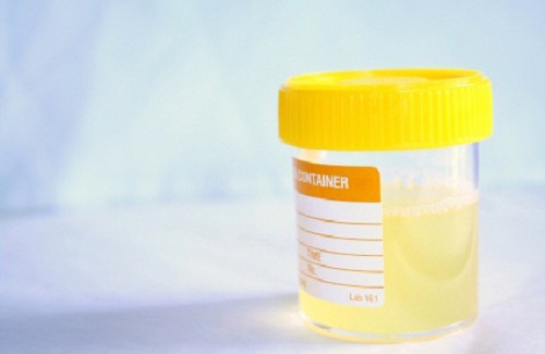 Remèdes maison pour soigner l'infection urinaire