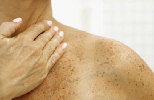 Comment stopper les signes de vieillesse?