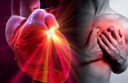 Ce que vous devez éviter si vous souffrez d'hypertension