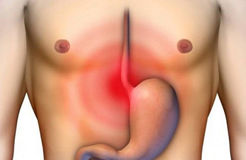 Les symptômes de l'inflammation de l’œsophage