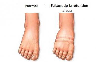Comment combattre la rétention d'eau